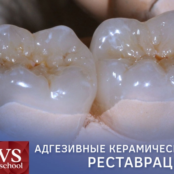 Карен Чавушьян курсы для стоматологов в Москве