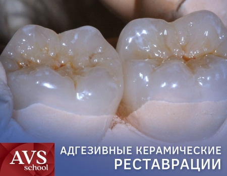 Карен Чавушьян курсы для стоматологов в Москве